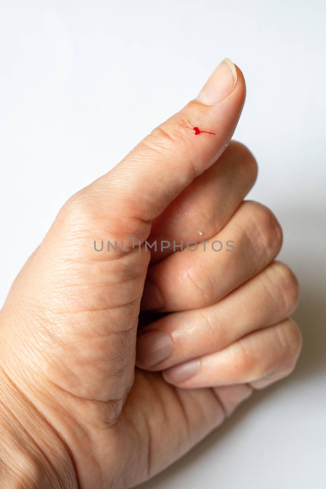 a finger on his hand was accidentally wounded with a knife by Serhii_Voroshchuk