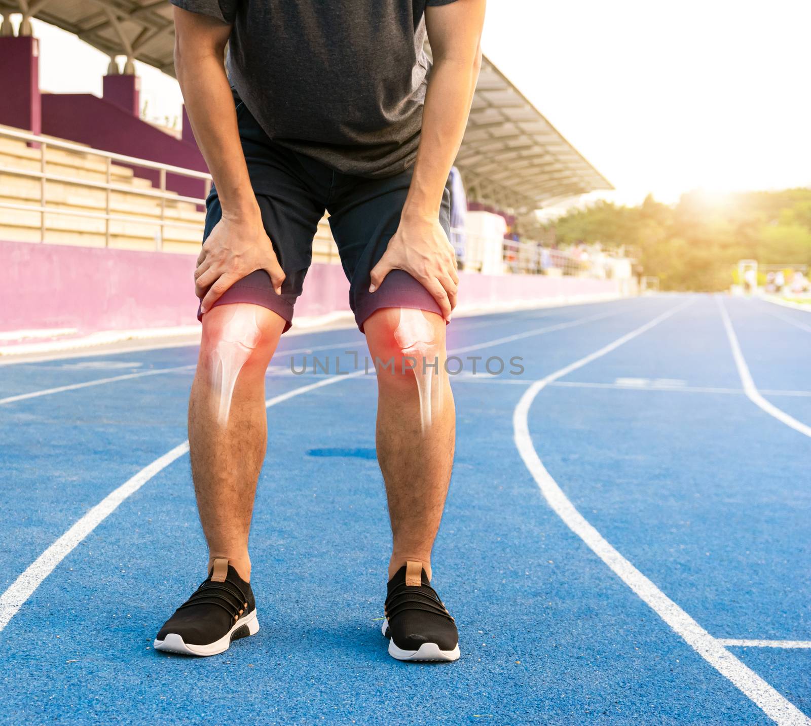 Runners to exercise knee joint bone Inflamed