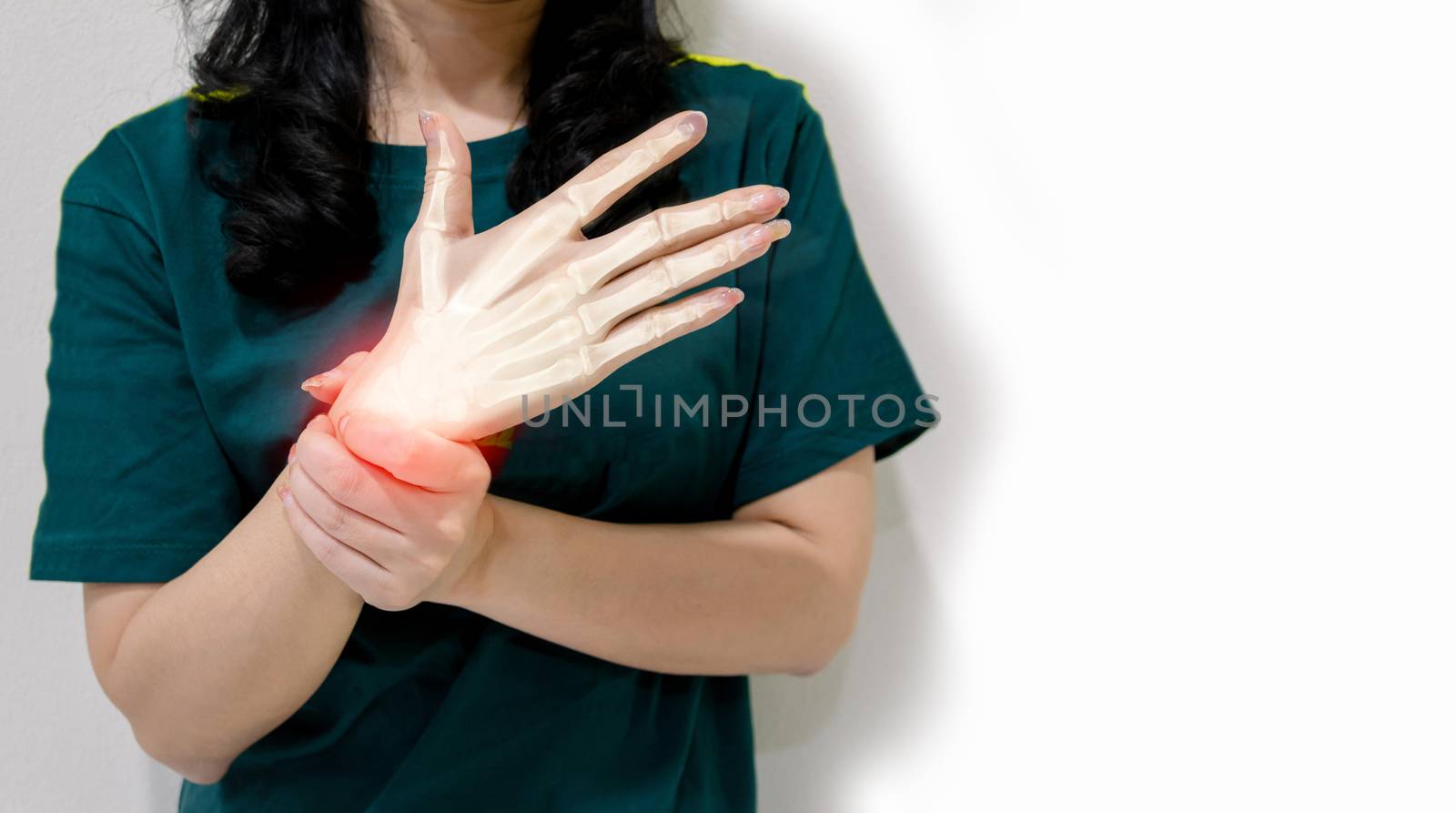 Inflamed hand wrist muscles and bones white background by sompongtom