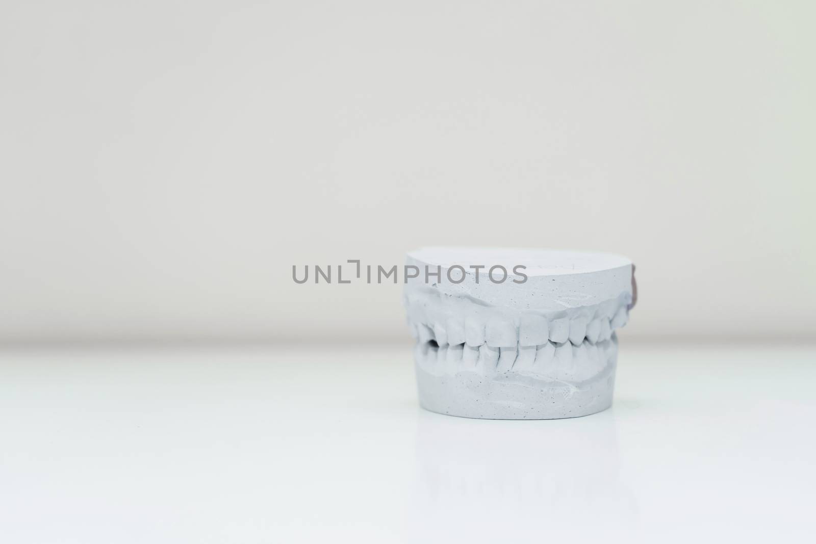 plaster cast of the jaw on a table in a bright room.
