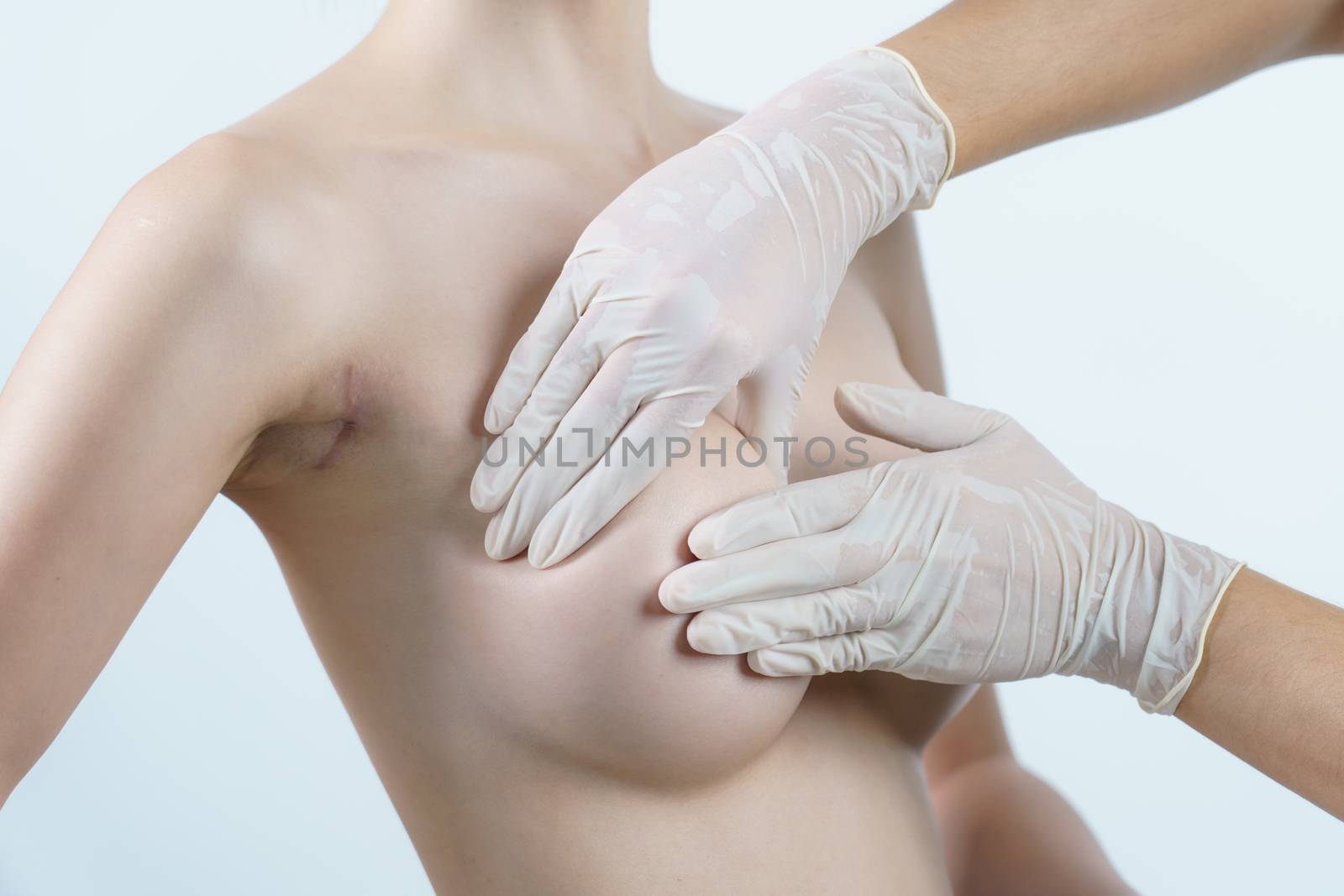 Doctor hand check up after breast surgery, breast implant surgery concept.