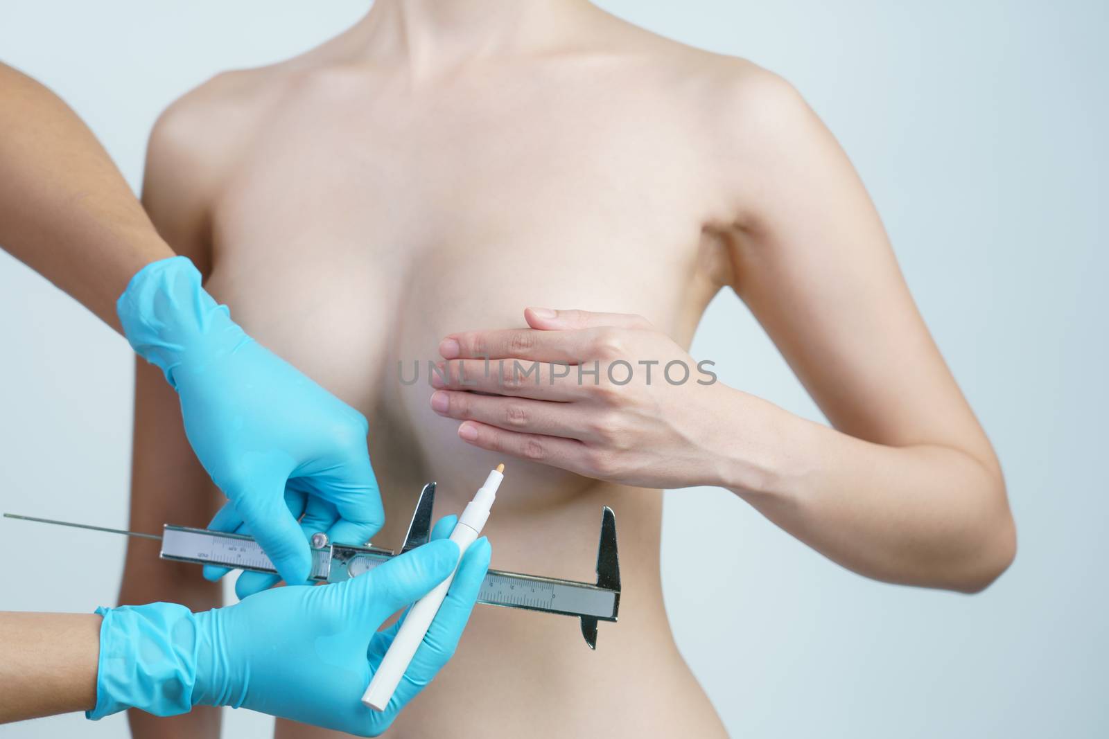 Doctor hand drawing lines and measurement woman breast with caliper, breast implant surgery concept.