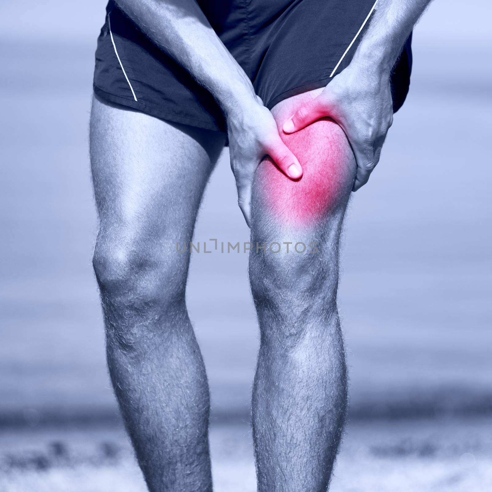 Muscle sports injury of male runner thigh by Maridav
