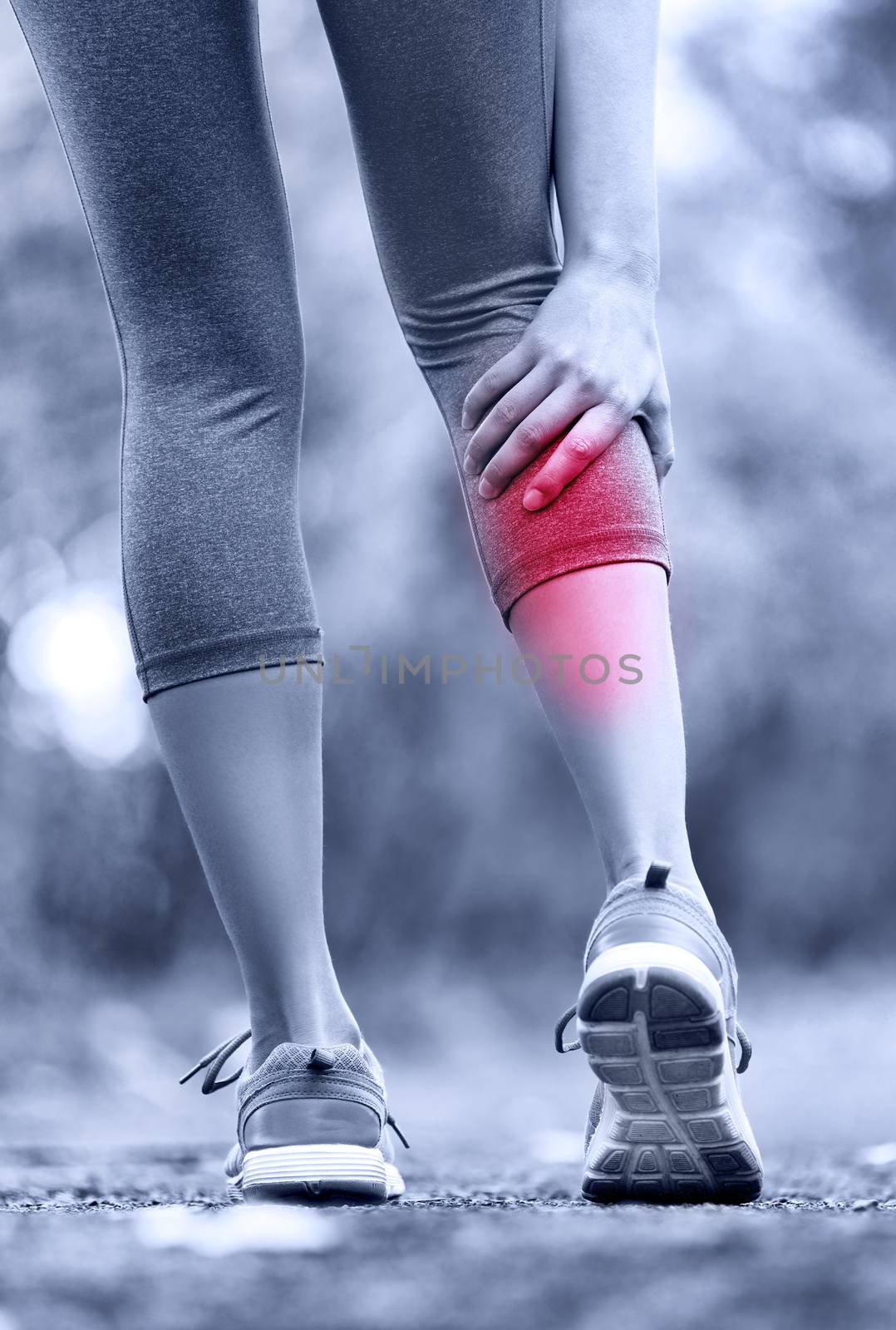 Muscle injury - woman running clutching calf muscle after spraining it while out jogging on the beach. Female athlete sport injury.