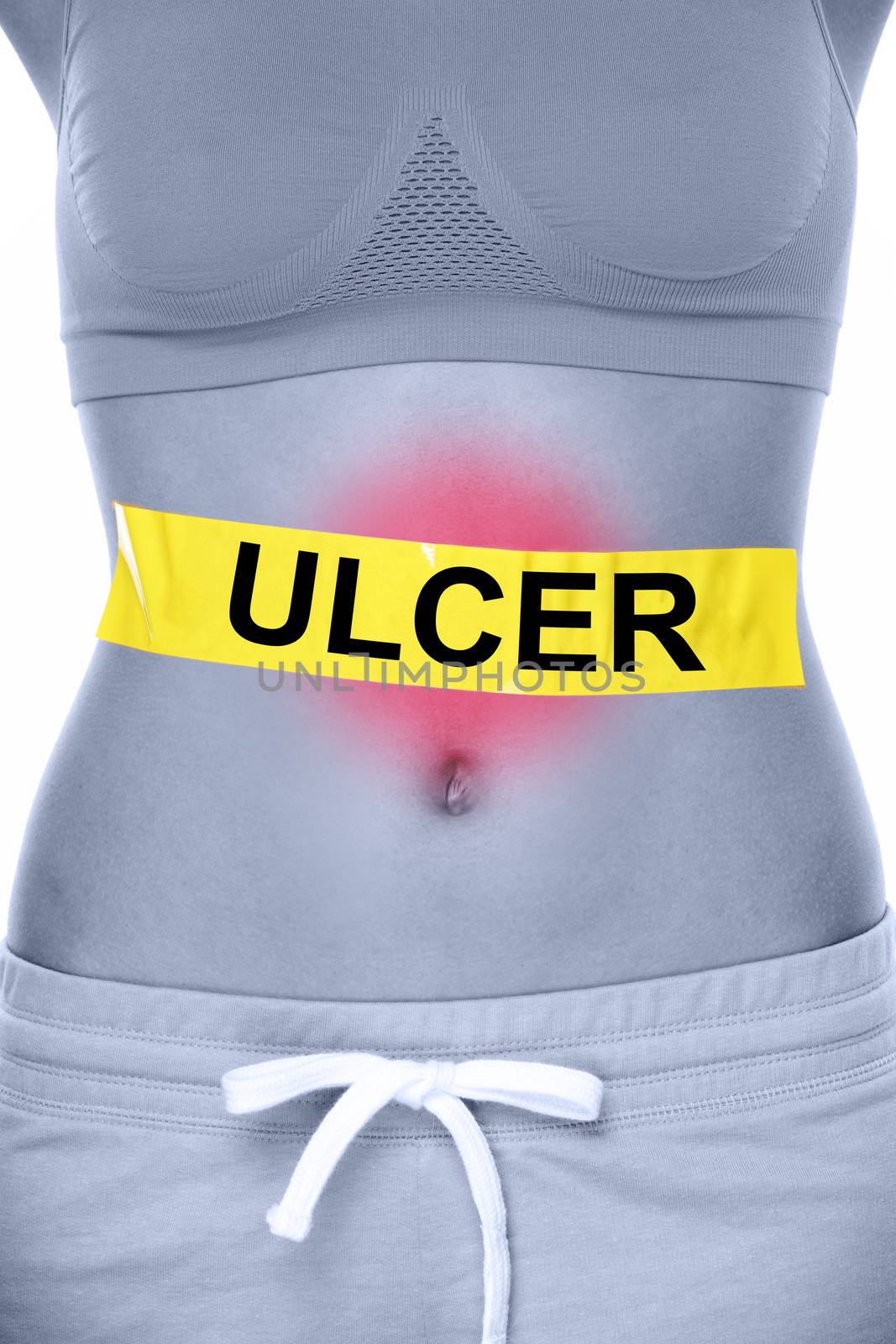 Stomach ulcer health problem showing woman abdomen by Maridav