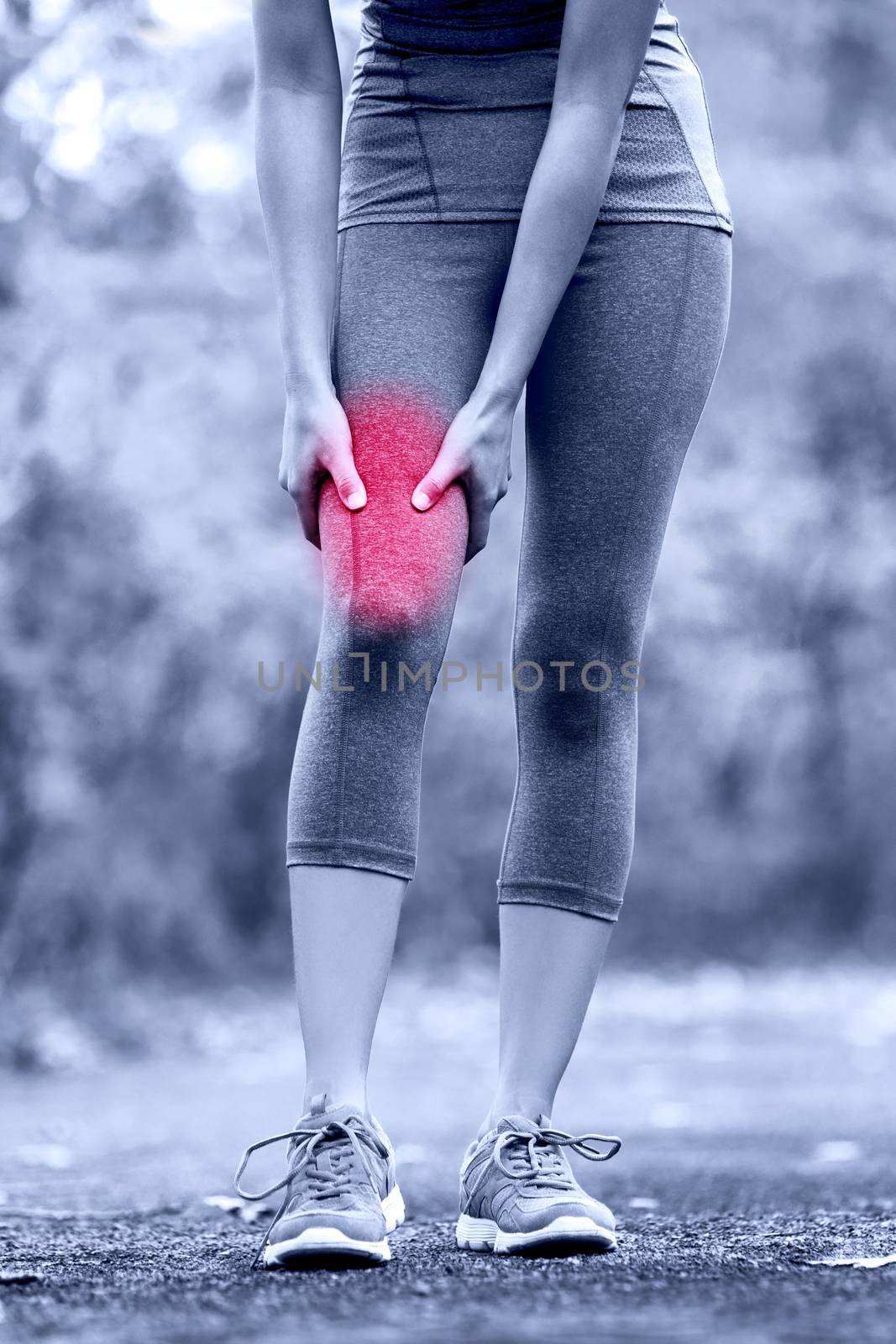 Muscle sports injury of female runner thigh by Maridav