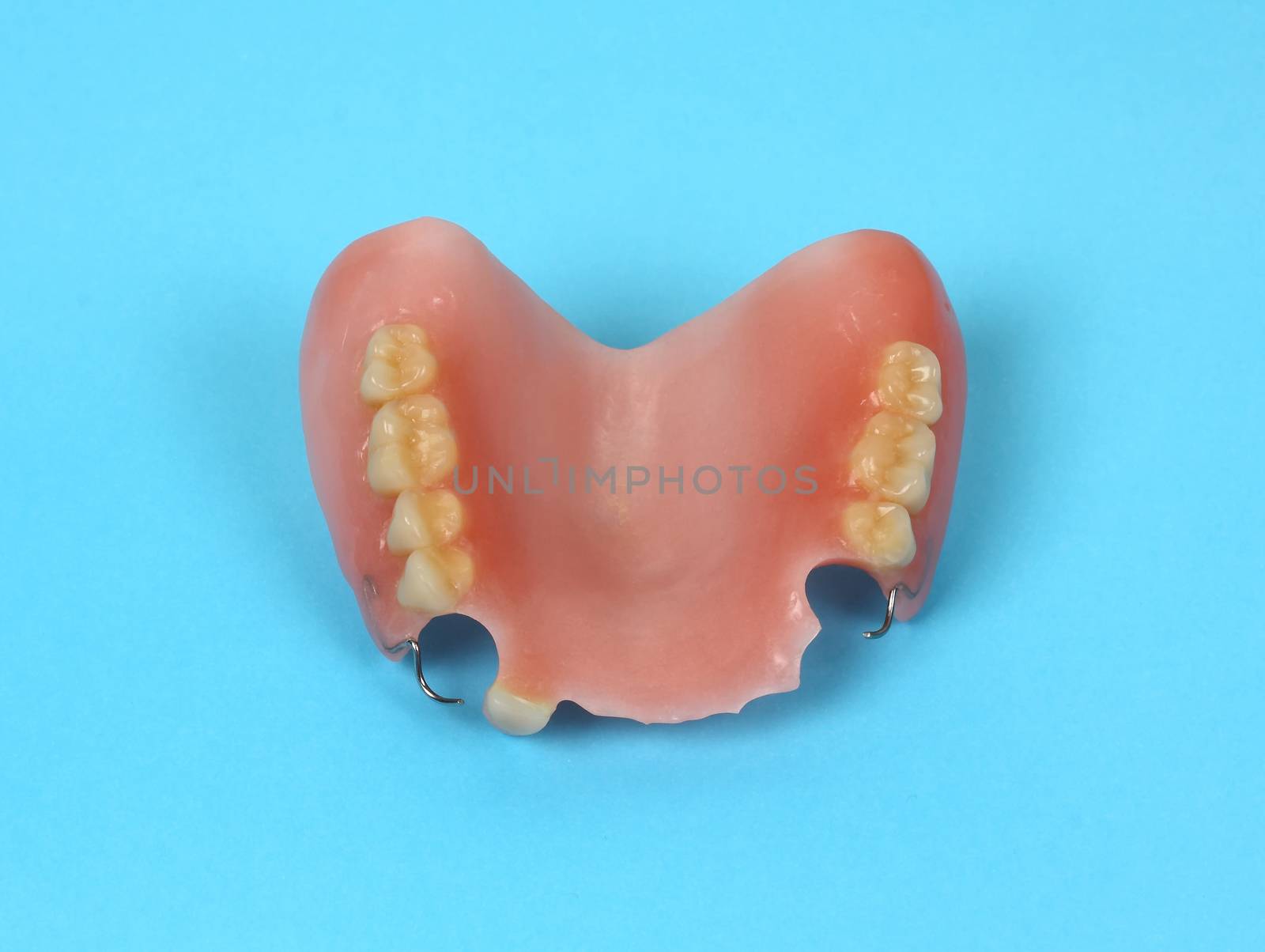 Dental prosthesis by Jova