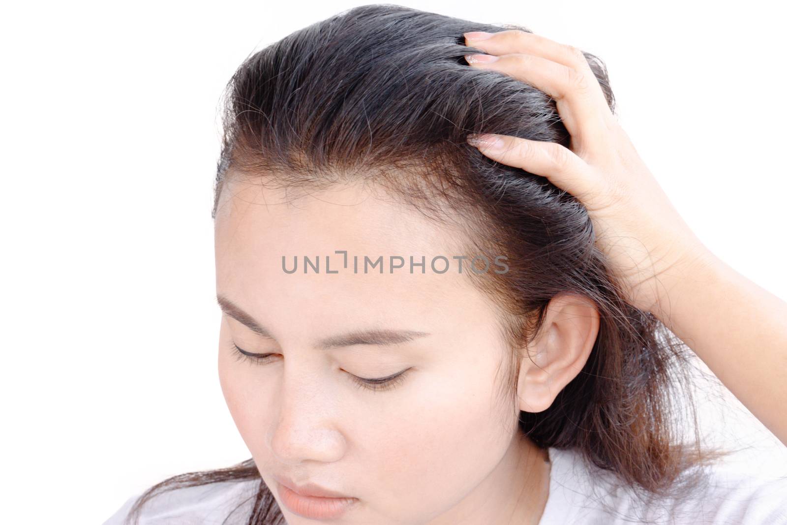 Woman serious hair loss problem for health care shampoo and beau by pt.pongsak@gmail.com