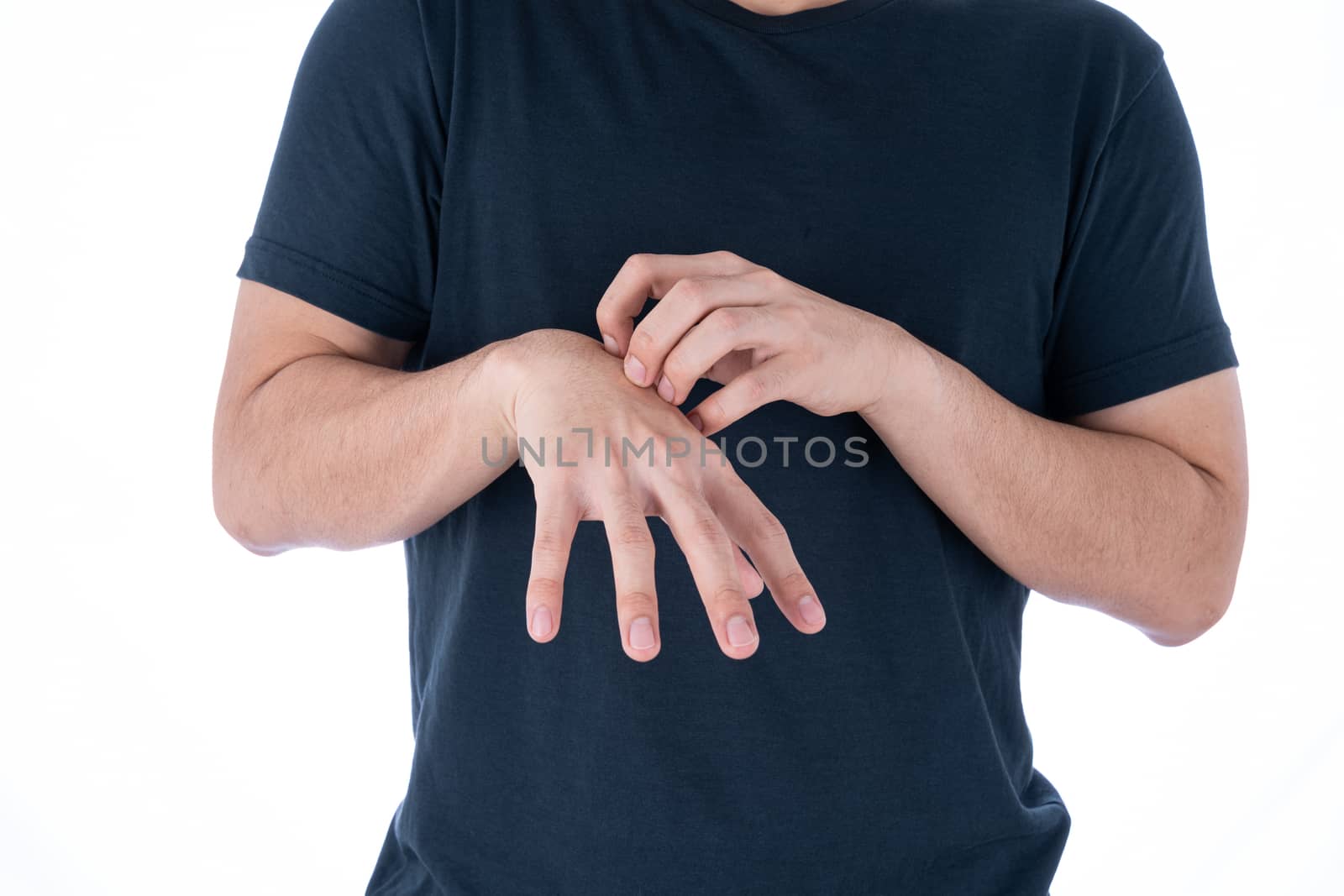 Male scratching his hand on isolated white background. Medical, healthcare for advertising concept.
