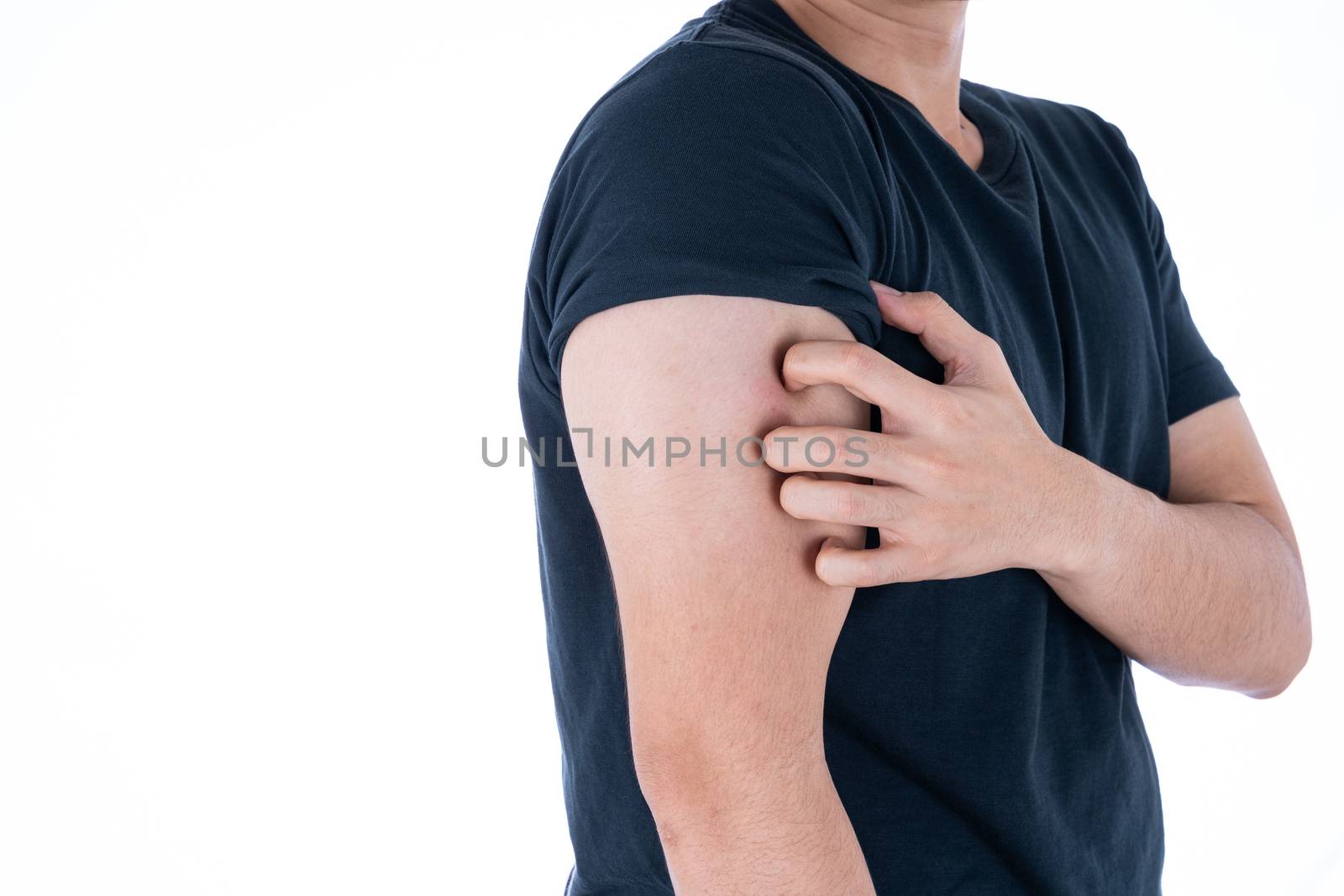Male scratching his arm on isolated white background. Medical, healthcare for advertising concept.