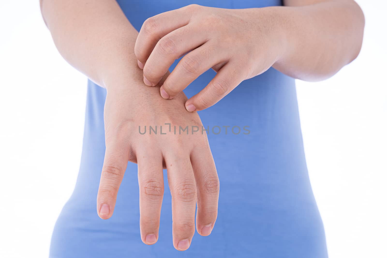 Female scratching her hand on isolated white background. Medical, healthcare for advertising concept.