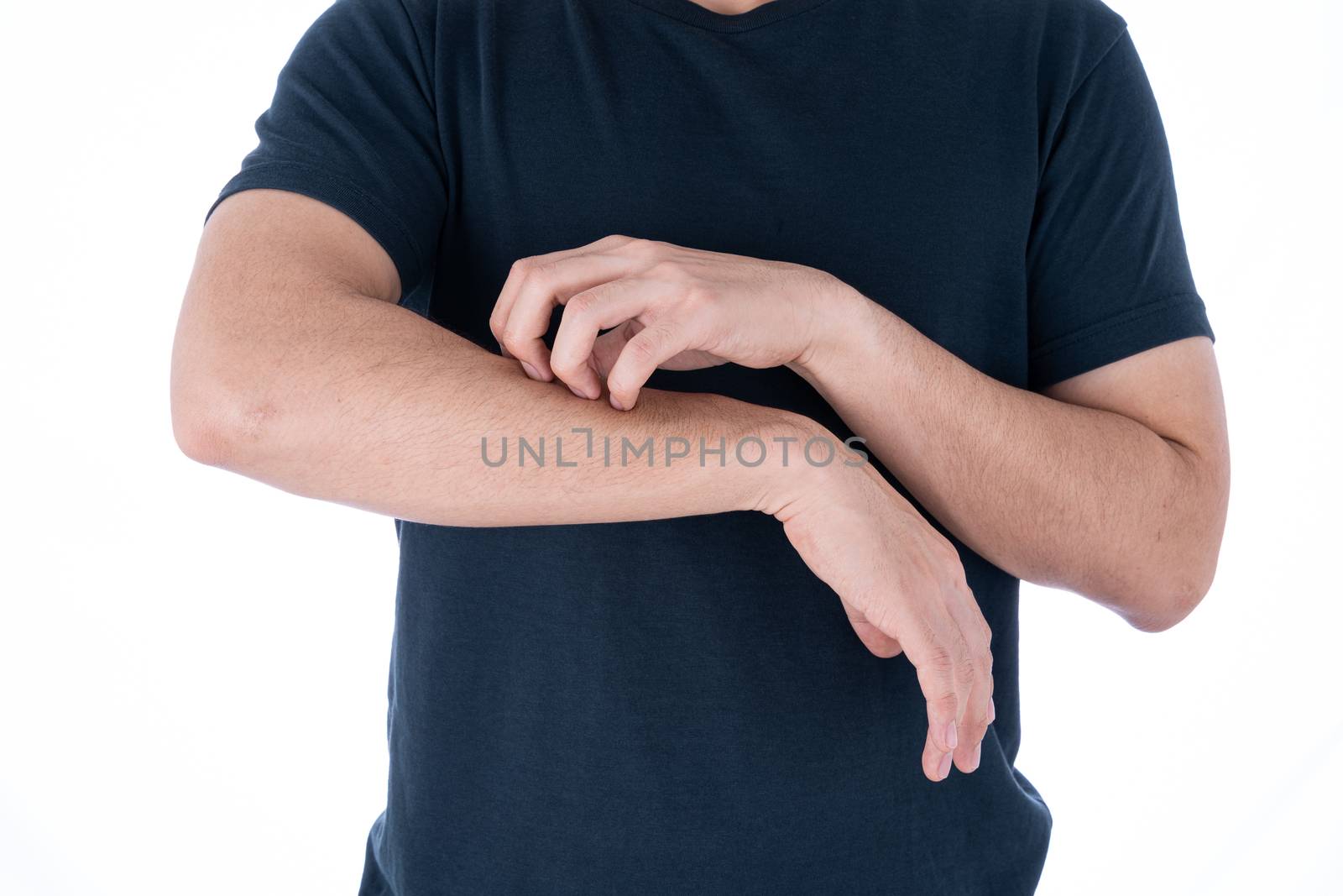 Male scratching his arm on isolated white background. Medical, healthcare for advertising concept.