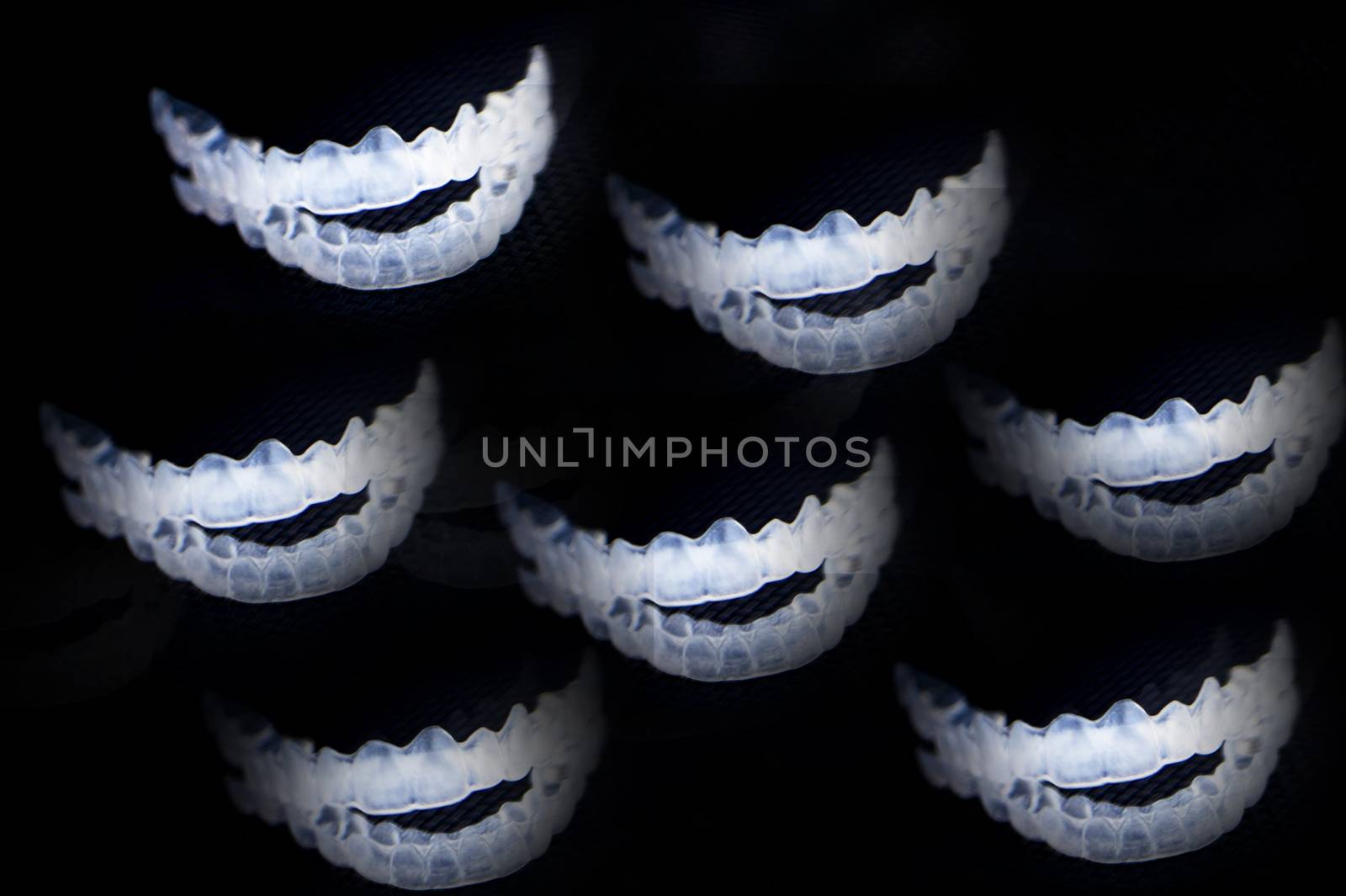 Invisible dental retention splint on black background by GemaIbarra