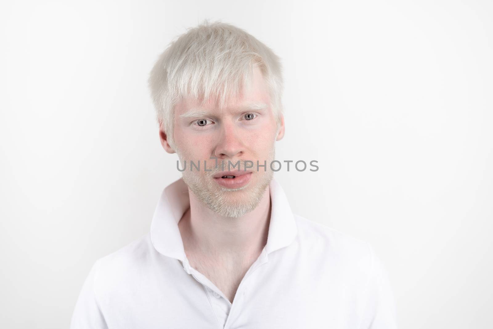 portrait of an albino man in studio dressed t-shirt isolated on a white background. abnormal deviations. unusual appearance by andreonegin