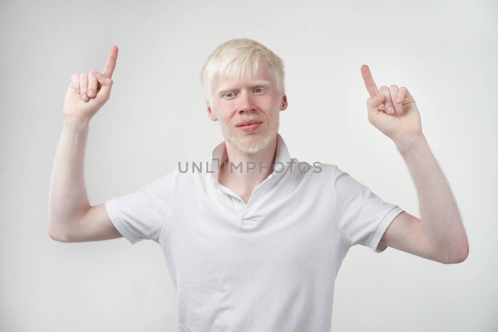 albinism albino man in studio dressed t-shirt isolated on a white background. abnormal deviations. unusual appearance by andreonegin