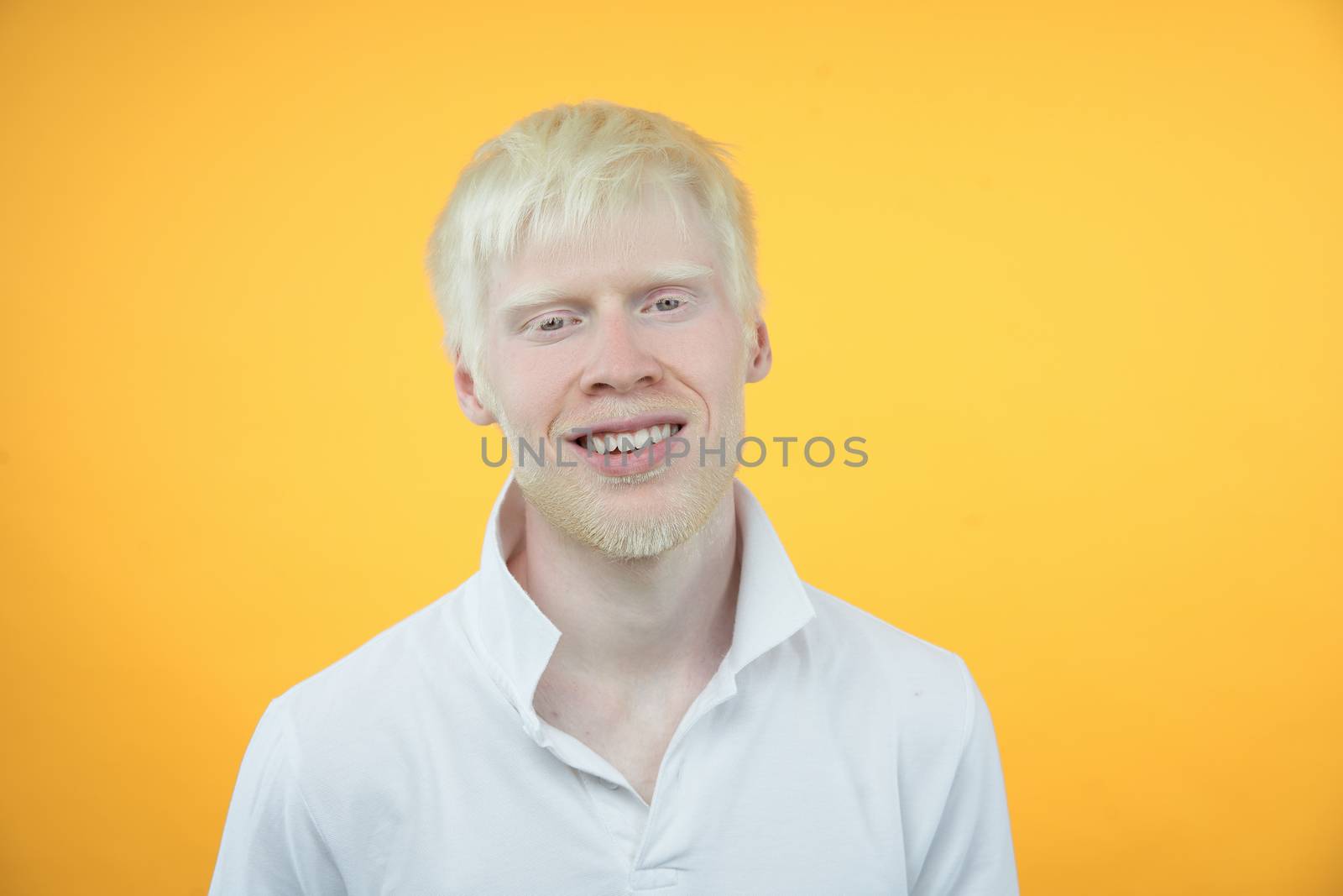 Happy smiling albino man white skin hair studio dressed t-shirt isolated yellow background abnormal deviations unusual appearance abnormality Beautiful people