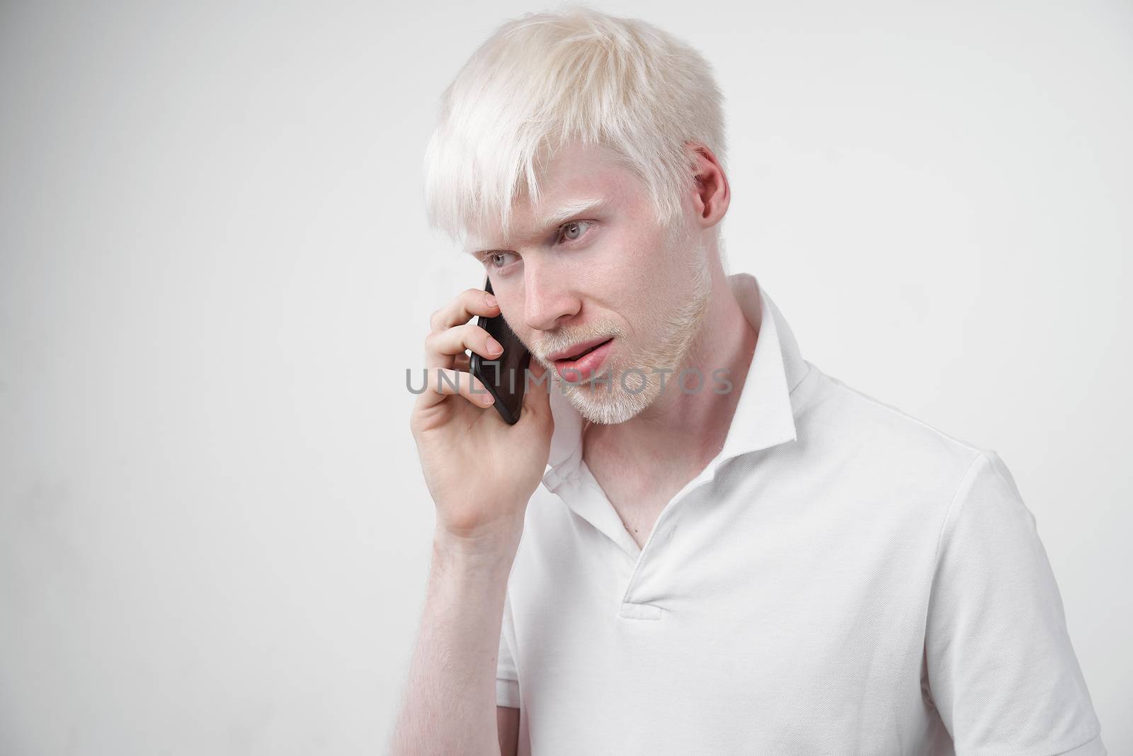 albinism albino man white skin hair studio dressed t-shirt isolated white background abnormal deviations unusual appearance abnormality Beautiful people Talking on the phone.
