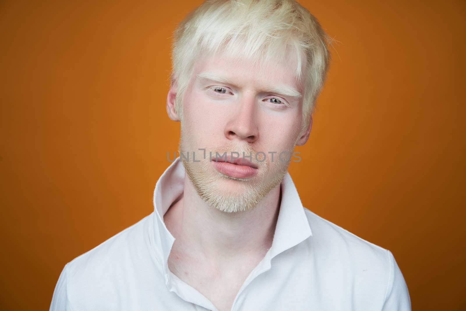 albinism Sad albino man white skin hair studio dressed t-shirt isolated yellow background. abnormal deviations. unusual appearance. skin abnormality Beautiful people with special appearance.