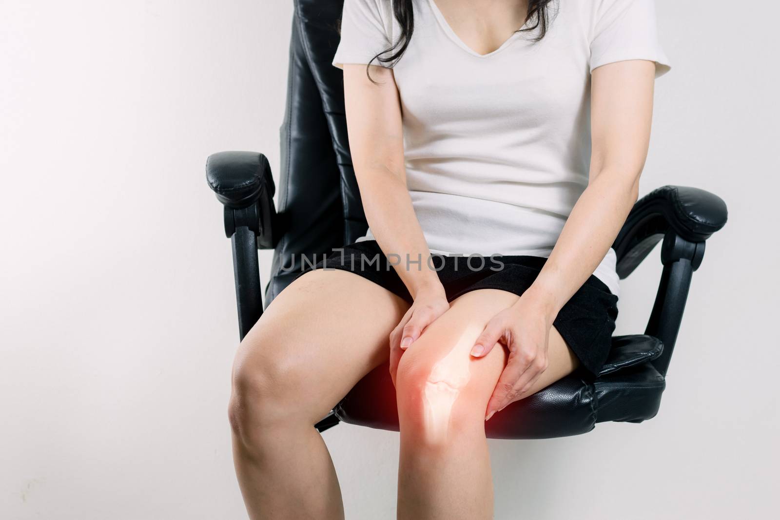 Human leg Osteoarthritis inflammation of bone joints  by sompongtom