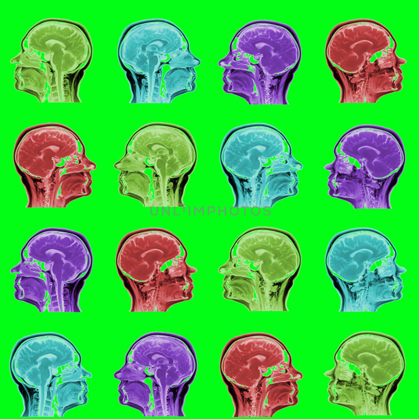 seamless pattern of MRI scans of sixty years old caucasian female head in sagittal or longitudinal plane - colored heads on acid green background by z1b