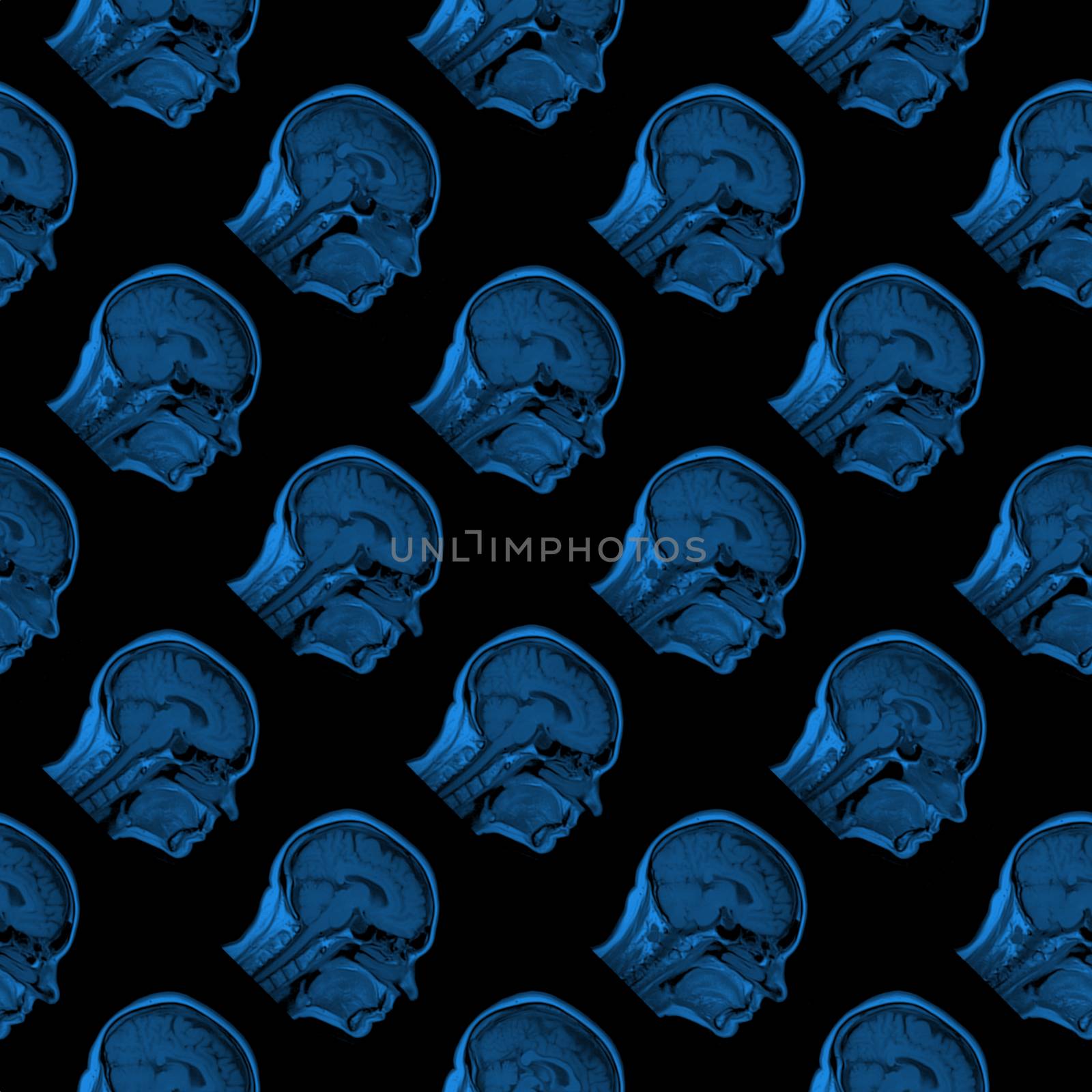 seamless pattern of serial MRI scans of sixty years old caucasian female head in sagittal or longitudinal plane - classic blue color on black background