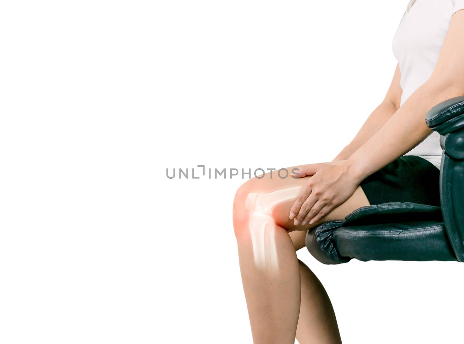 Human leg Osteoarthritis inflammation of bone joints 