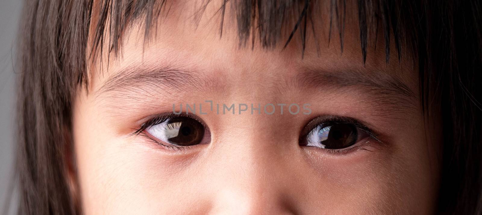 Portrait of child half face with sad and cry expression. by TEERASAK