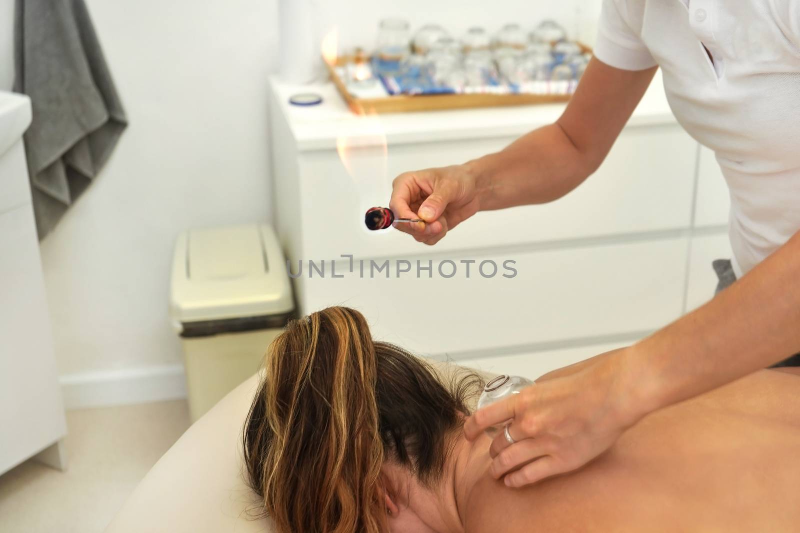 Young female physiotherapist applying glass suction banks on back of her patient, holding open flame above during cupping therapy, closeup detail.