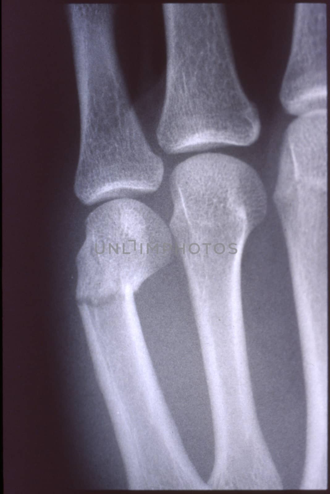 X-ray image, man, hand with bones and joints