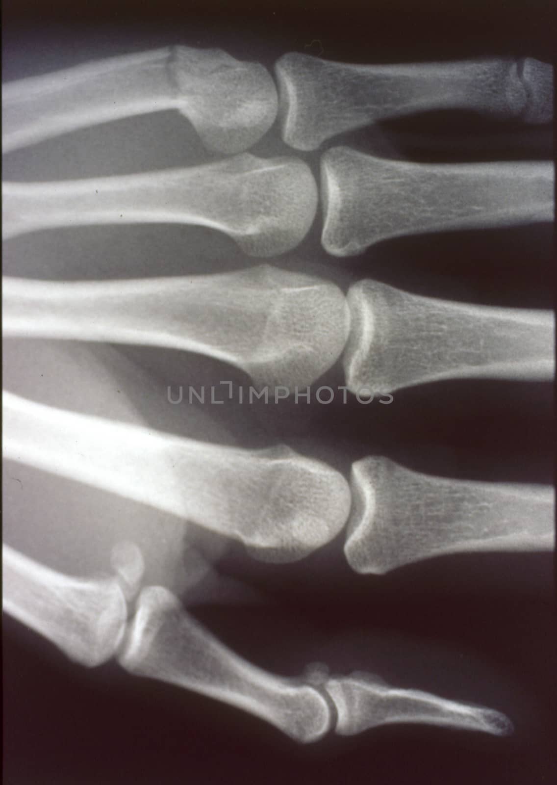 X-ray image, man, hand with bones and joints