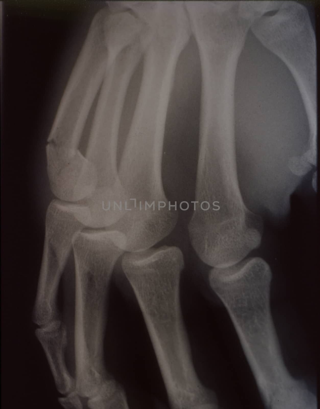 X-ray image, man, hand with bones and joints