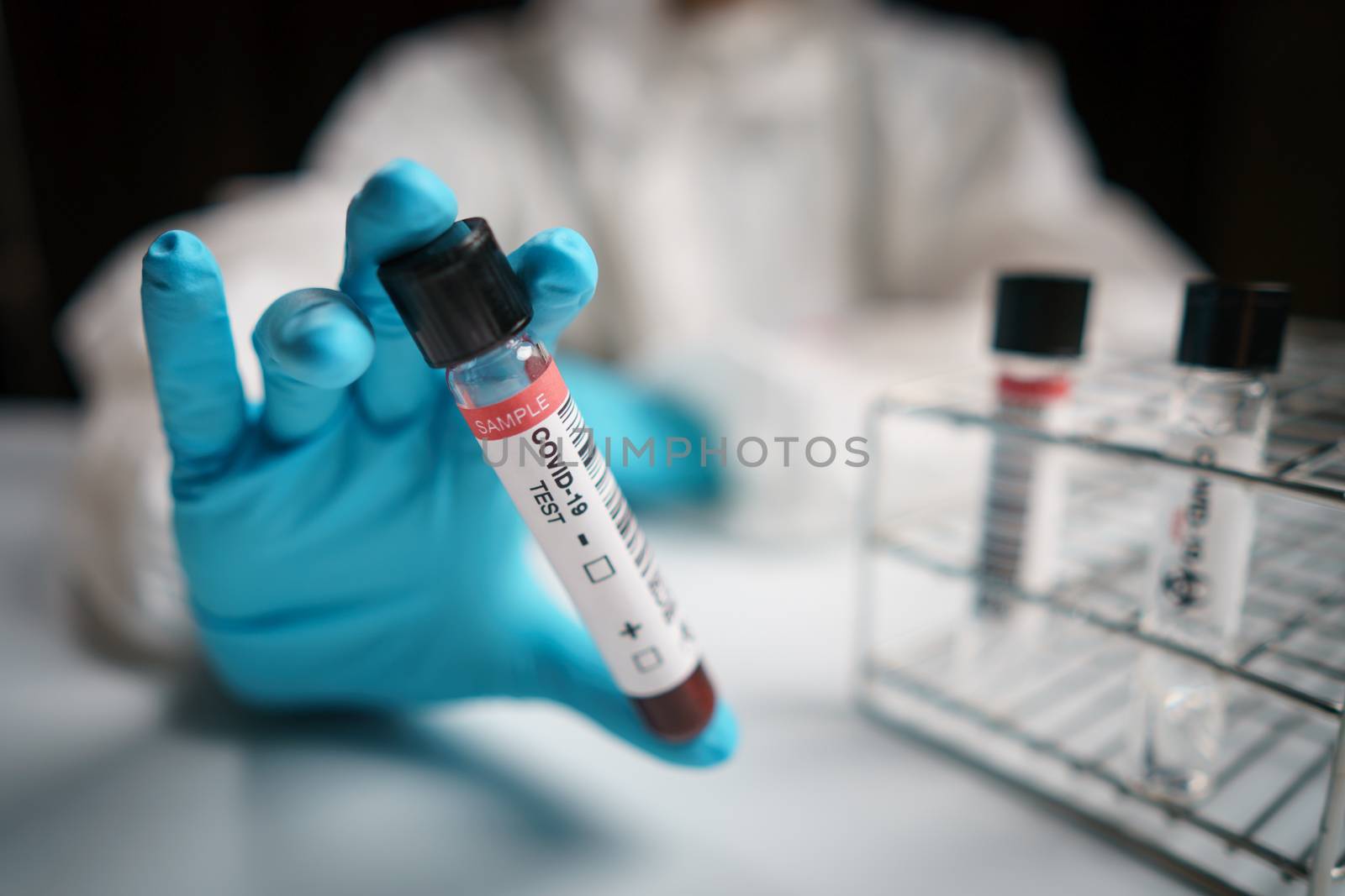 Coronavirus testing, a hand holds tube of blood test samples of by sirawit99