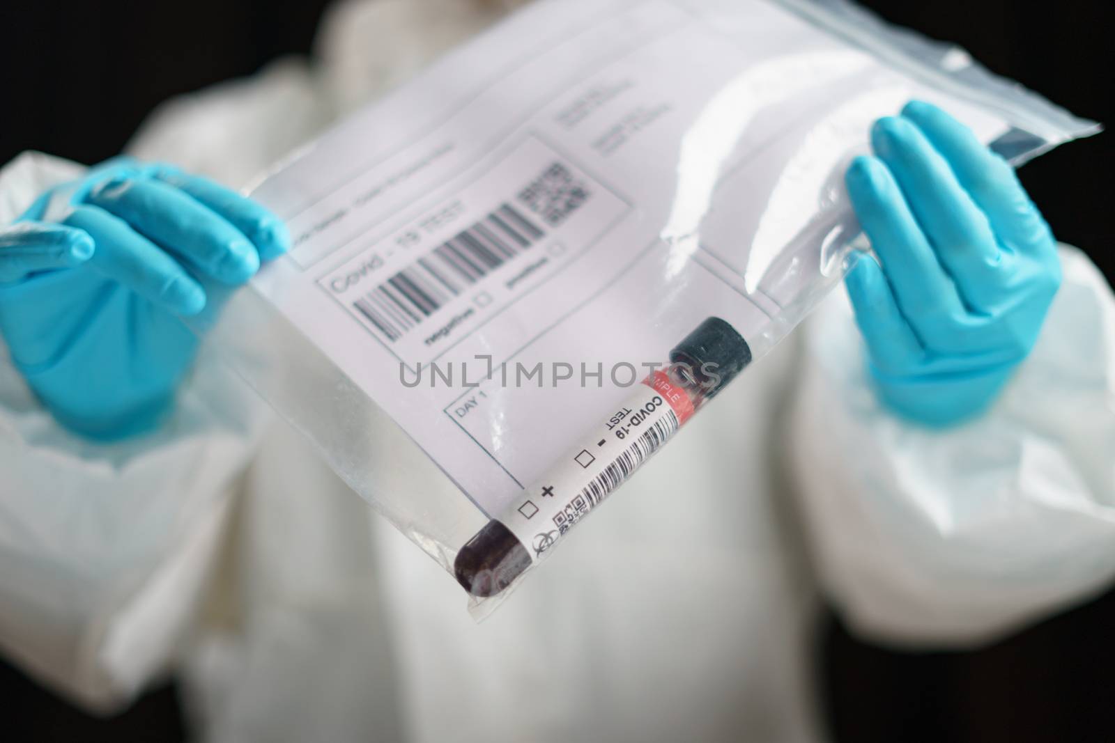 Coronavirus testing, a hand holds transparent bag with tube of b by sirawit99