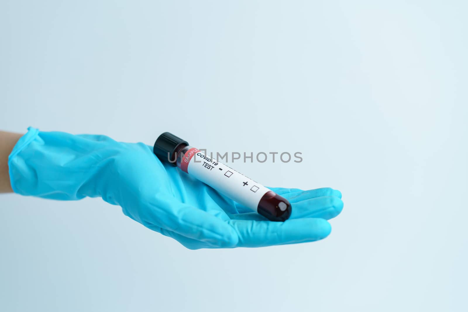 Hand with blue glove holding blood test tube samples of coronavi by sirawit99