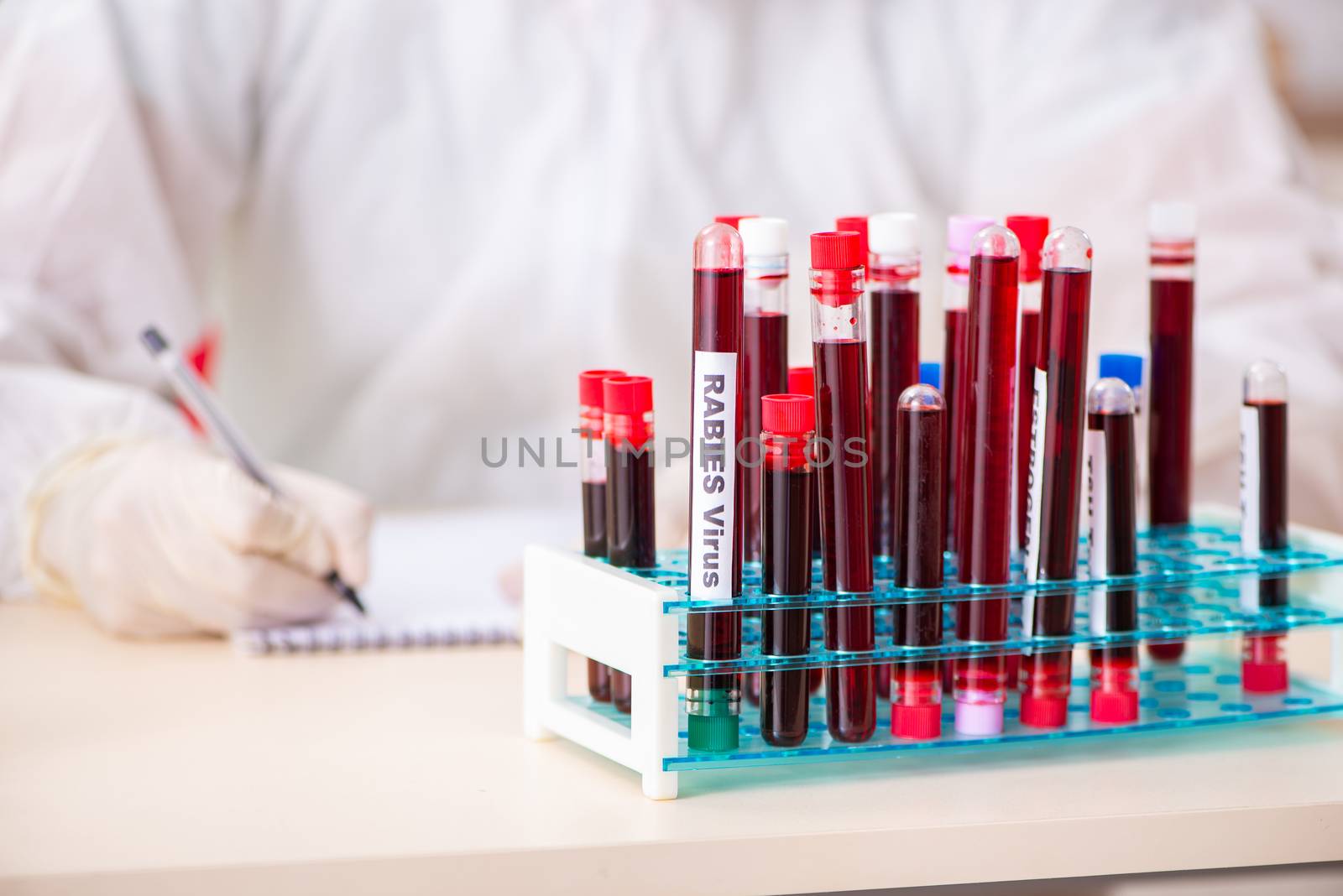 Young handsome lab assistant testing blood samples in hospital 