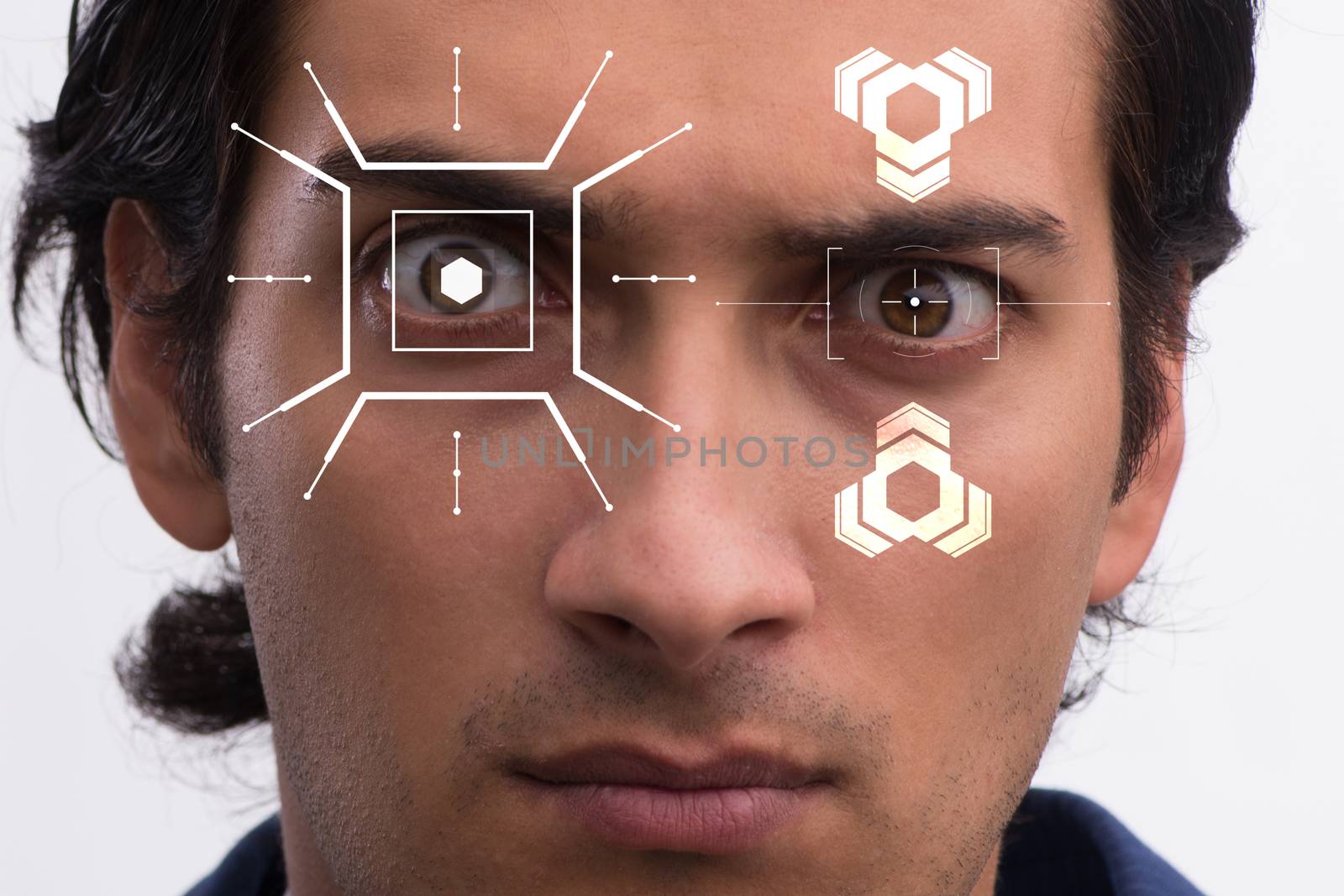 Concept of sensor implanted into human eye by Elnur