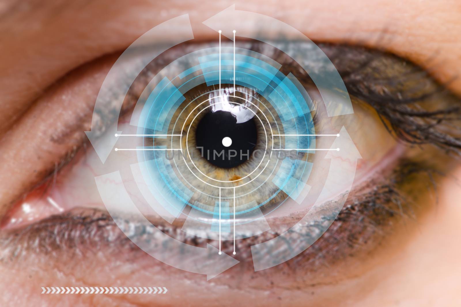 Concept of sensor implanted into human eye by Elnur