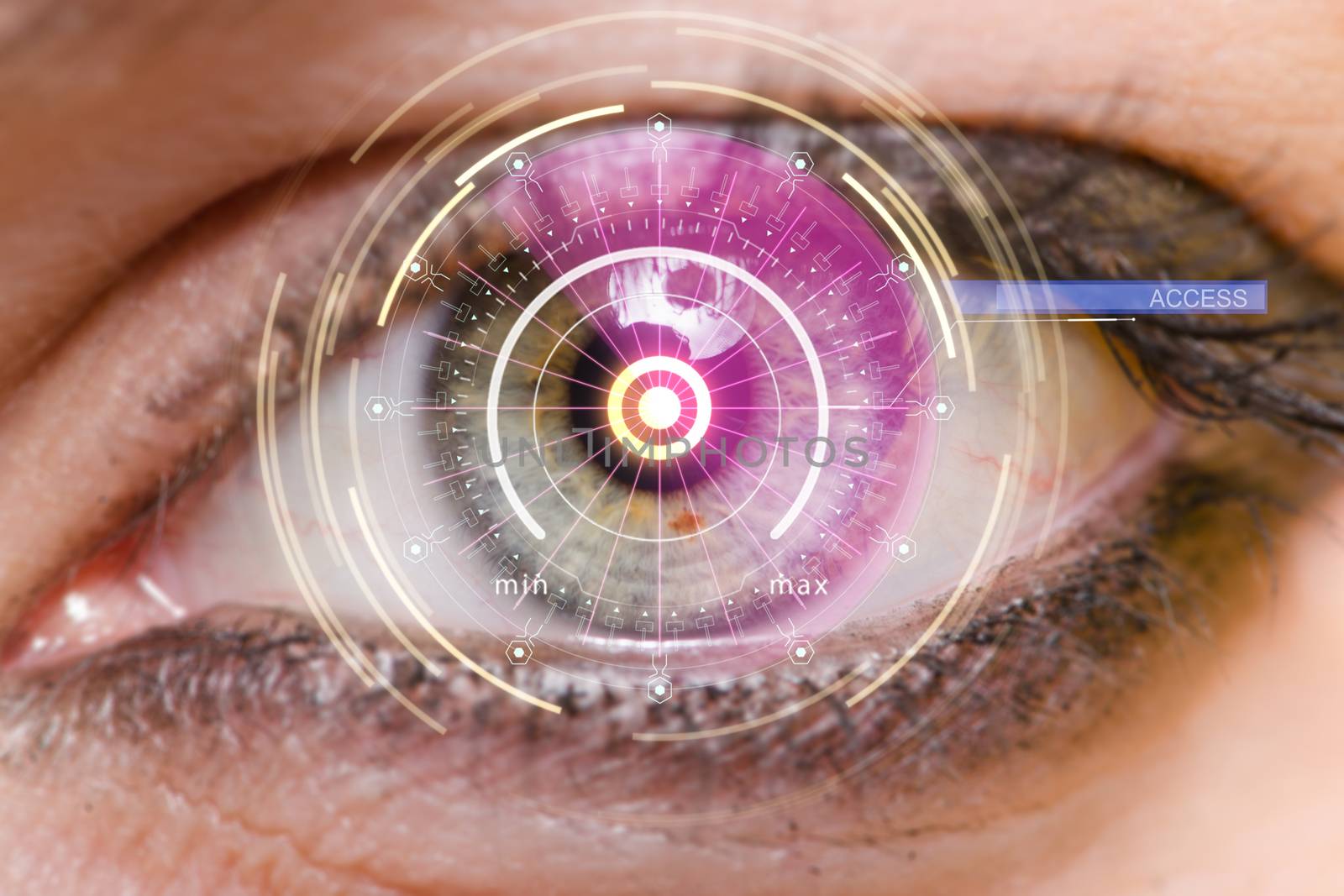 Concept of sensor implanted into human eye by Elnur