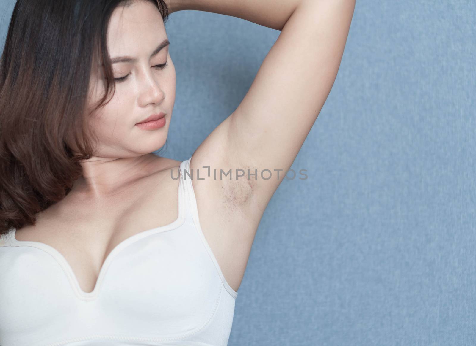 Women problem black armpit with grey background for skin care an by pt.pongsak@gmail.com