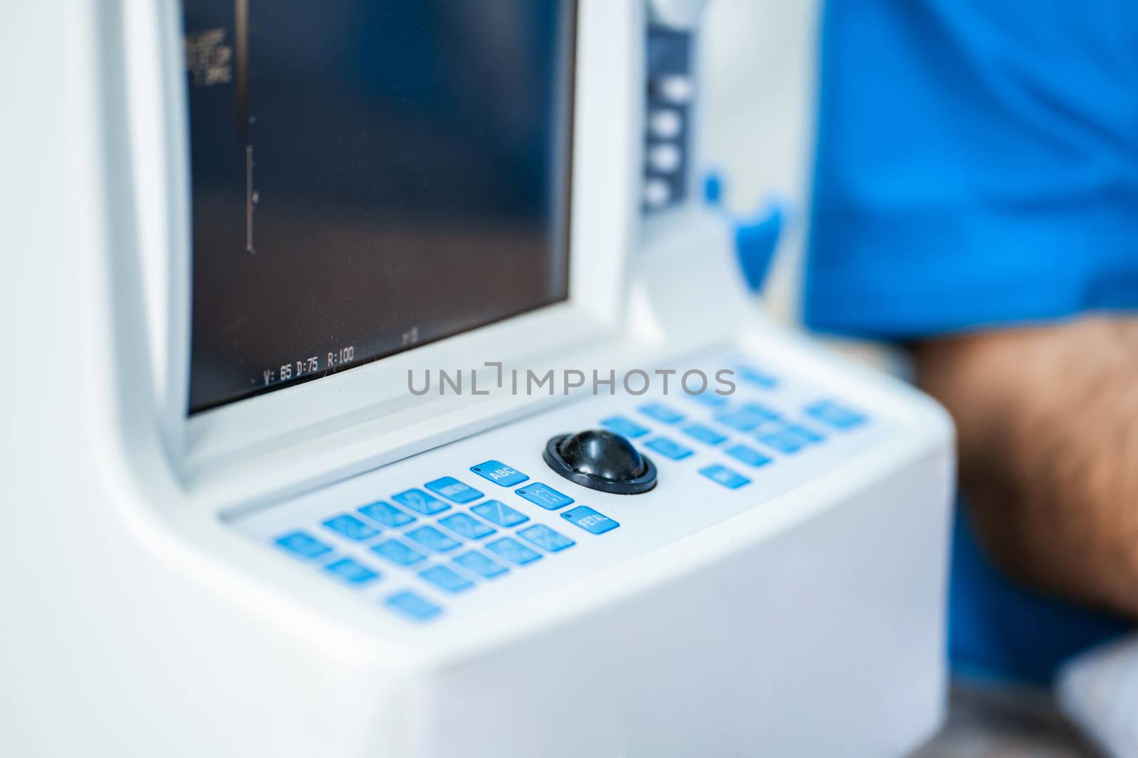 professional equipment of veterinary clinics. A mobile ultrasound diagnostic device for animals