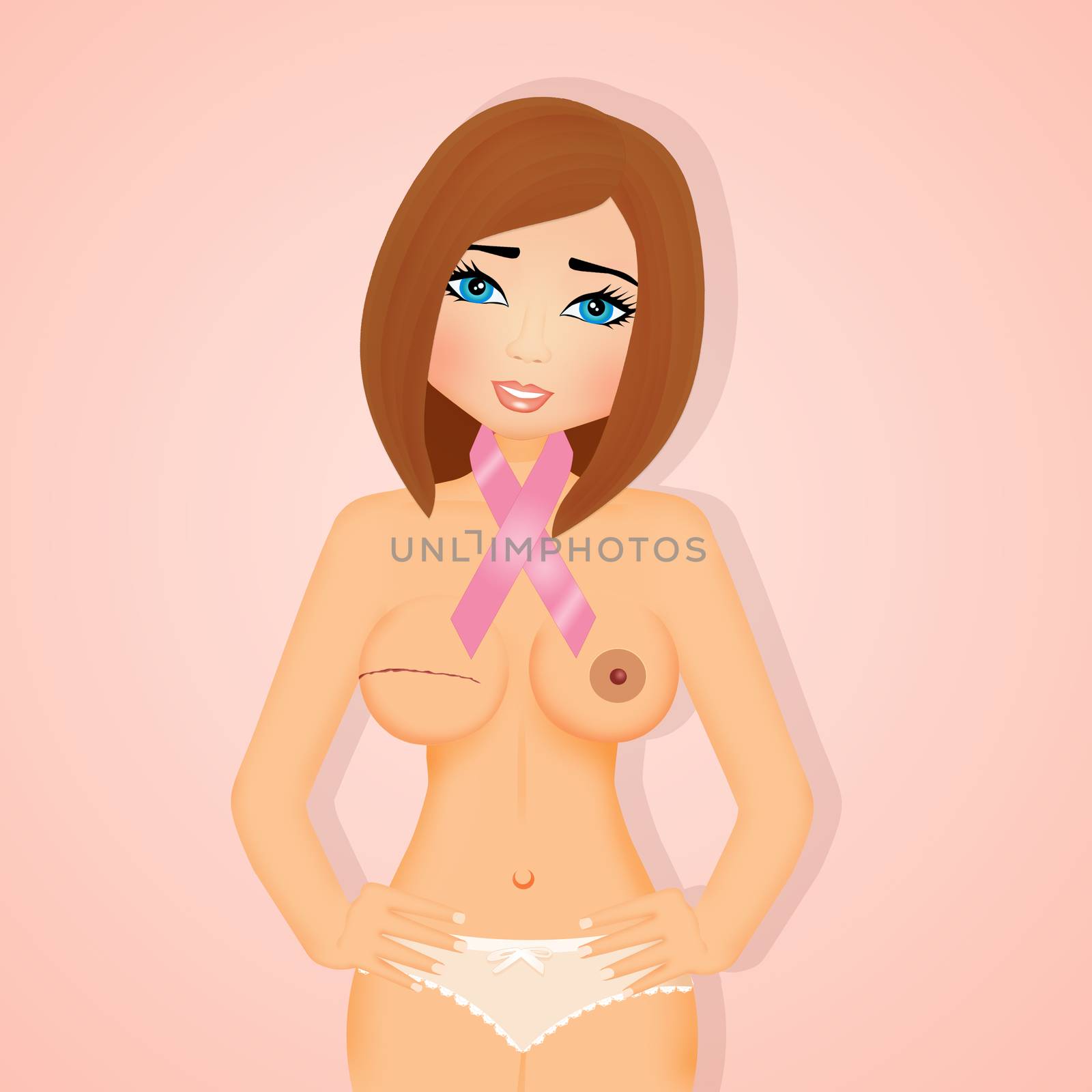 illustration of woman with breast cancer