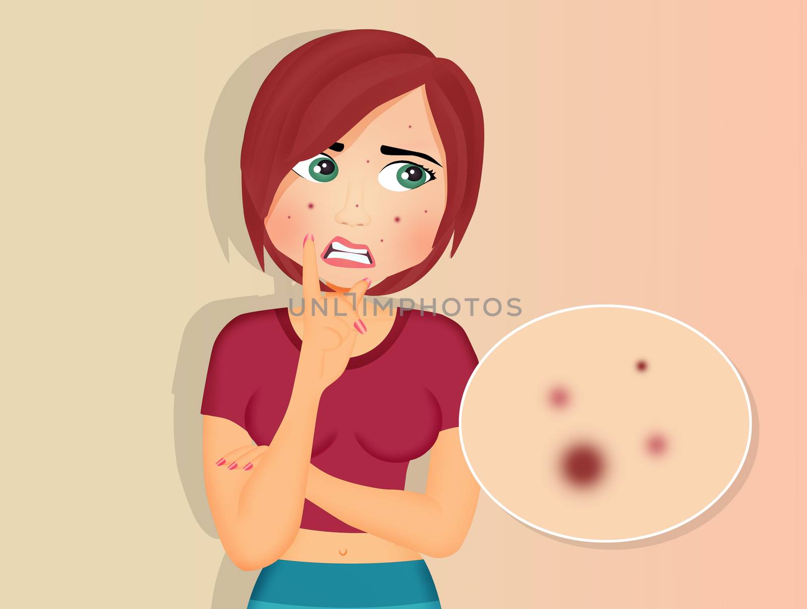 cute illustration of girl with acne