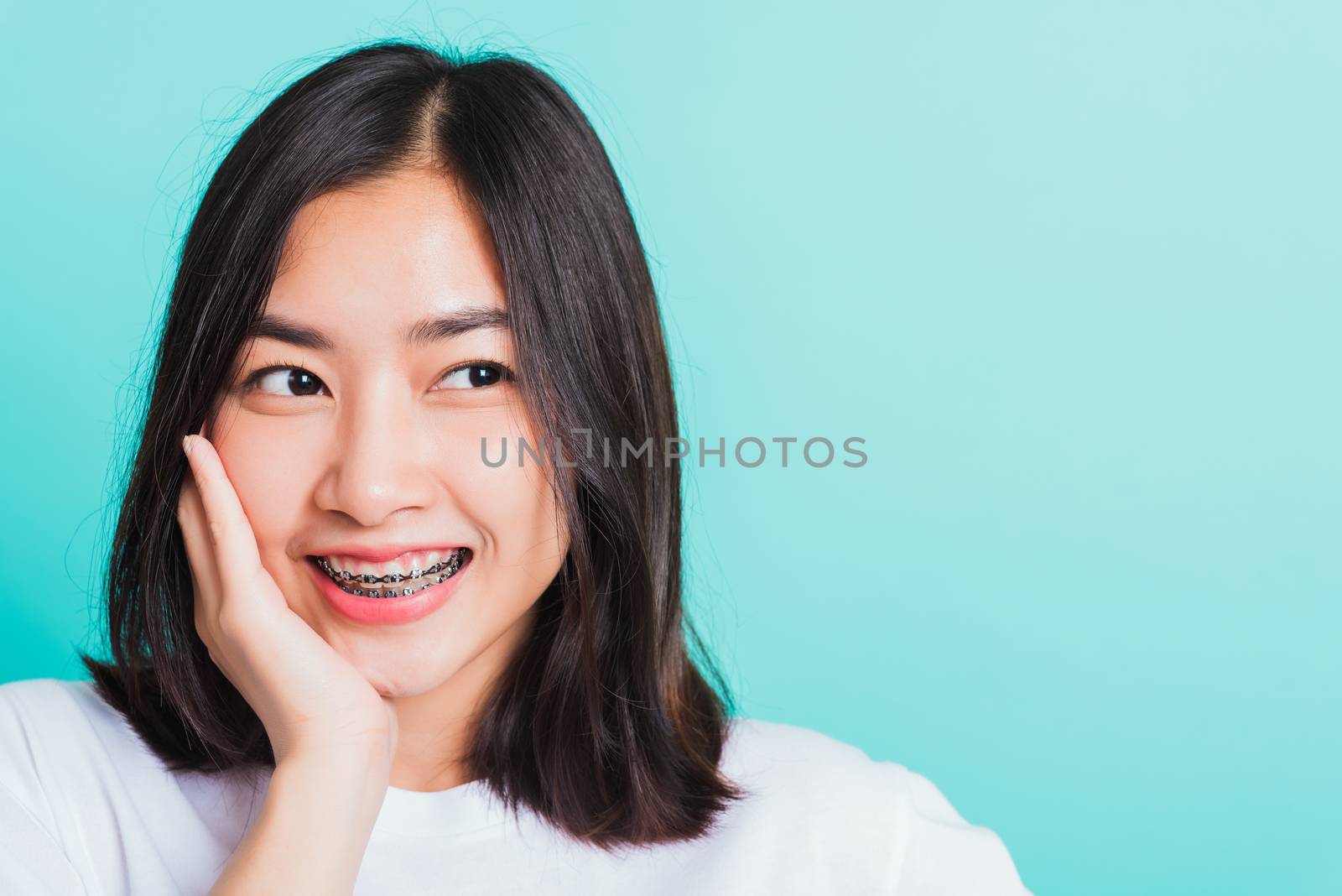 Portrait of Asian teen beautiful young woman smile have dental braces on teeth laughing she touching her face by hand, studio shot isolated on a blue background, Medicine and dentistry concept