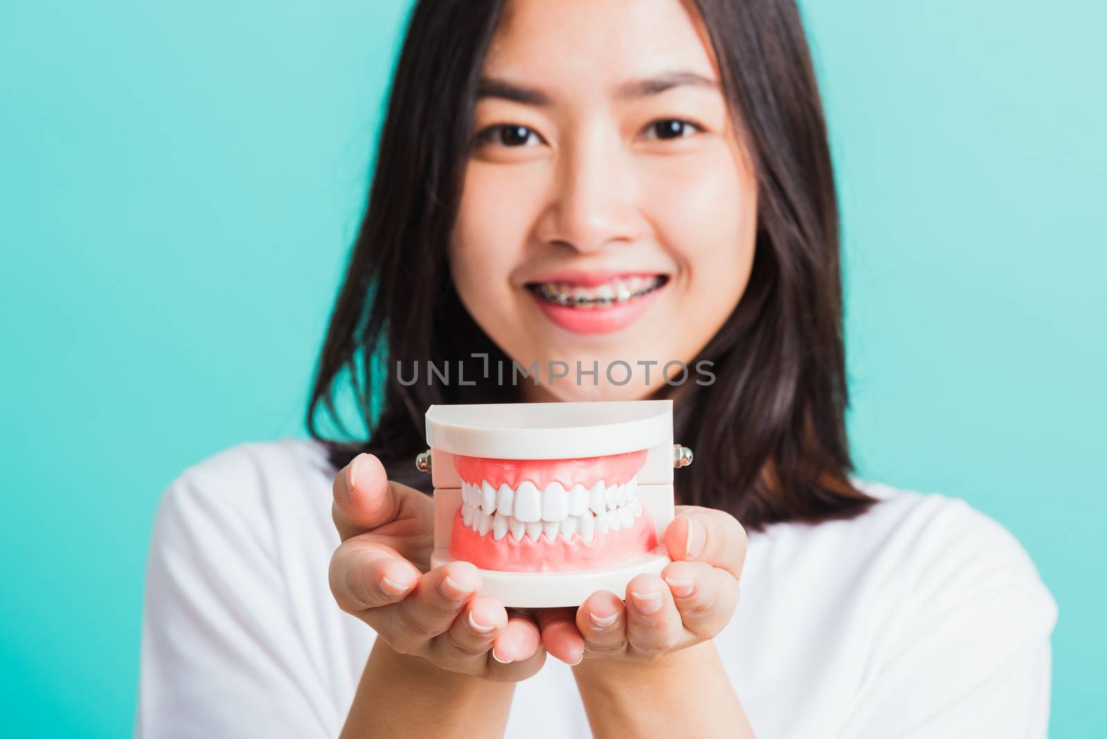 Portrait of Asian teen beautiful young woman smile have dental braces on teeth laughing she holding medical equipment dental model teeth, isolated on a blue background, Medicine and dentistry concept