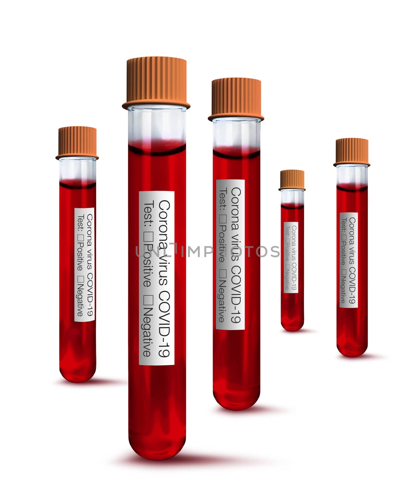 Blood test tubes for medical laboratory analysis and corona viru by anterovium