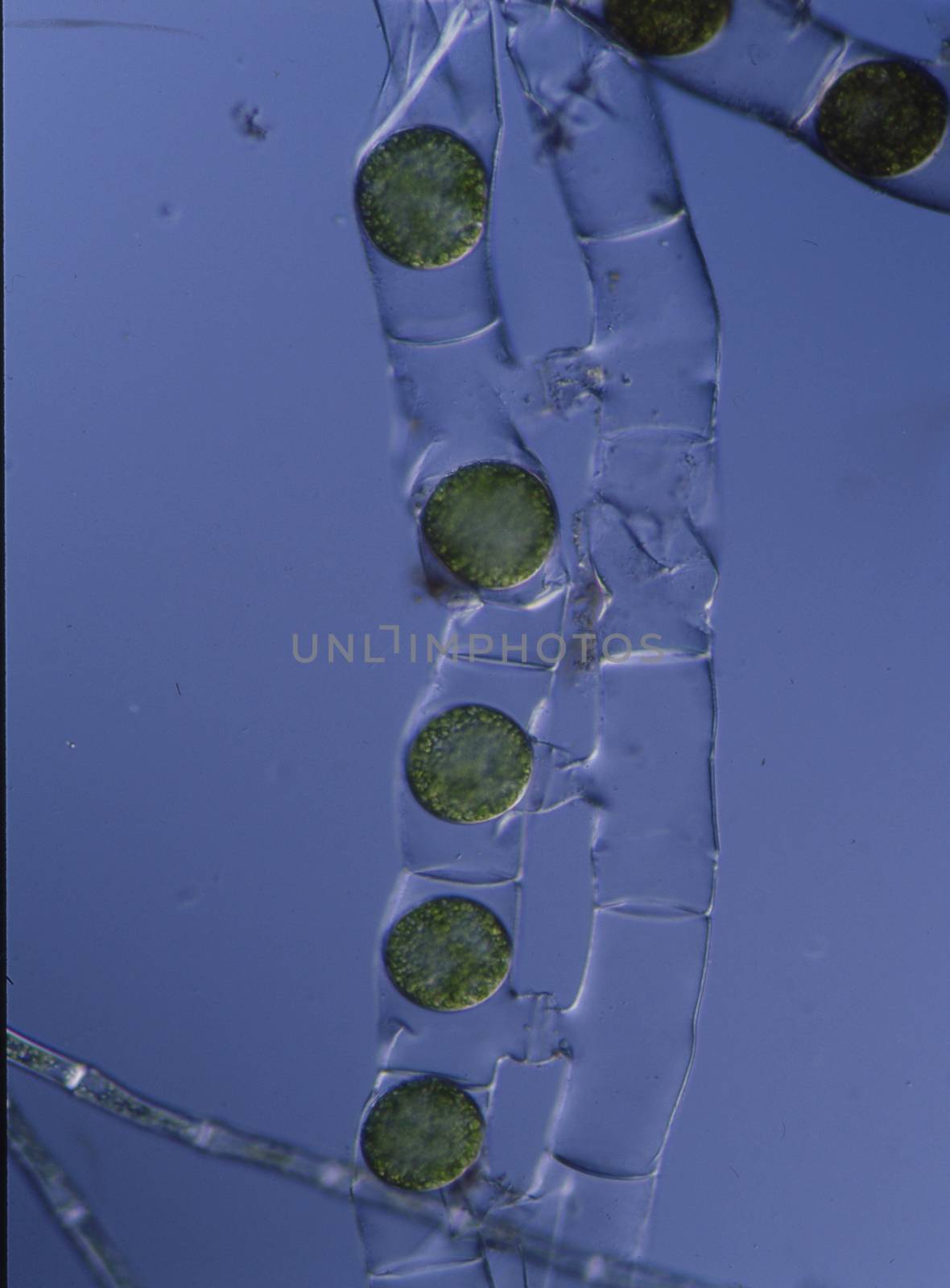 elongated green algae in the water under the microscope