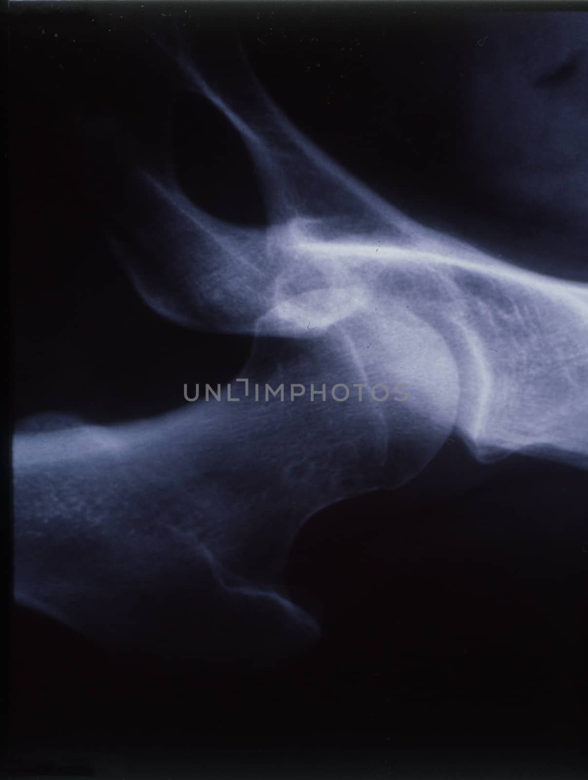 X-ray image, man, hand with bones and joints by Dr-Lange