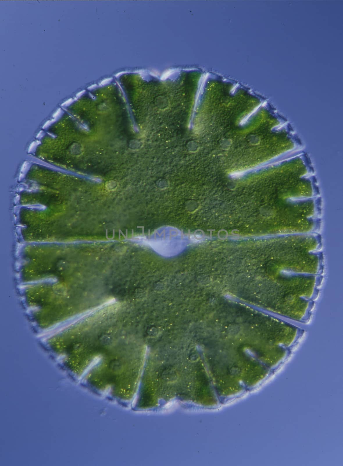 Ornamental algae Micrasterias in drops of water 100x by Dr-Lange