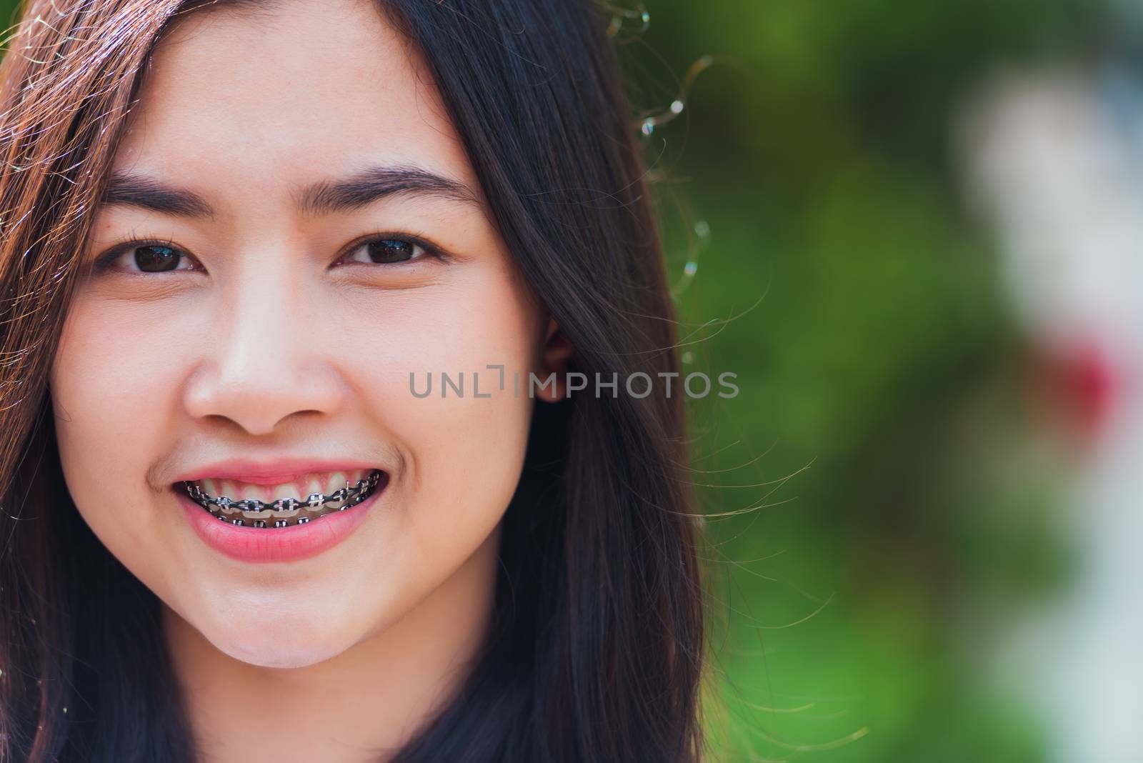 woman smile have dental braces on teeth laughing outdoor by Sorapop