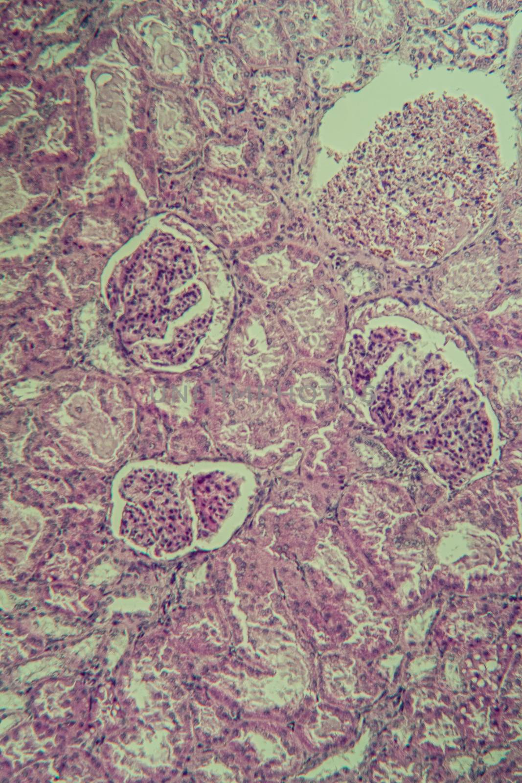 Cross section of the kidney with Glumeroli 100x by Dr-Lange